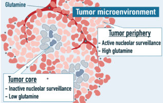 Glutamine & Nucleolar surveillance