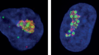 The “iNo score”: Towards bringing the nucleolus in the clinics